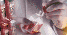 Menstrual Cramp cell culture